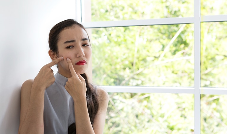 Concept for skin care and face problem. The girl is dismayed with acne on the face. Asian woman unhappy touching her skin.