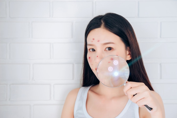 Asian woman with laser acne removal technology her face and hold Magnifying glass.