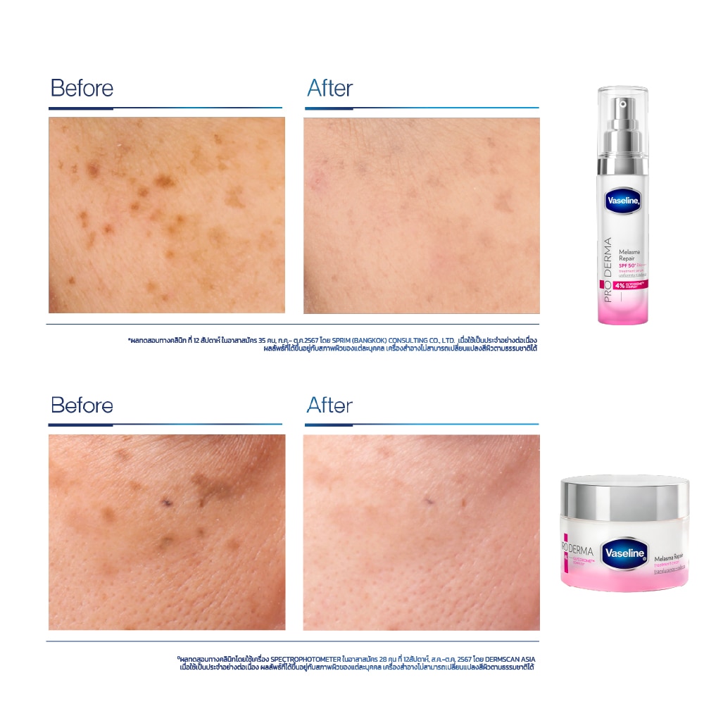 ผลิตภัณฑ์ในกลุ่ม Melasma Repair