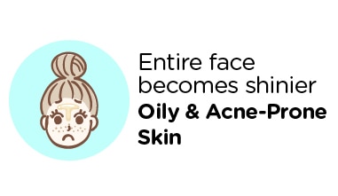 Skin type- oily skin